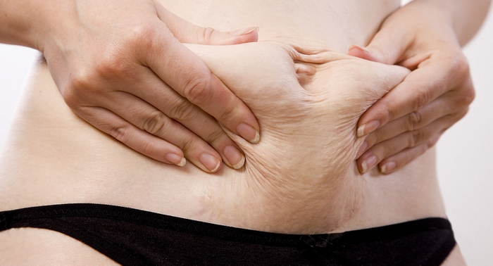 Como Acabar Com A Flacidez Na Barriga Mercado Bom Sucesso